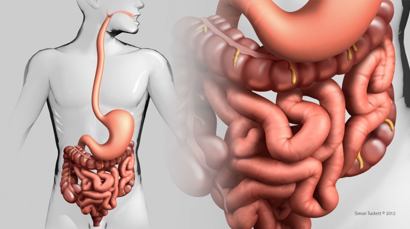 Casos de câncer de intestino aumentam entre jovens