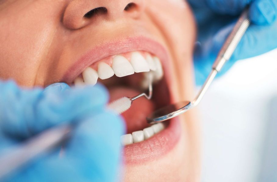 Universidade oferece tratamento gratuito para extração de dente em São Paulo