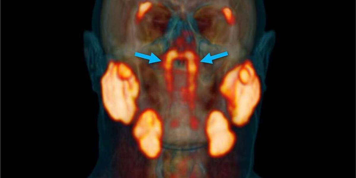 Cientistas descobrem acidentalmente um novo órgão dentro da cabeça humana