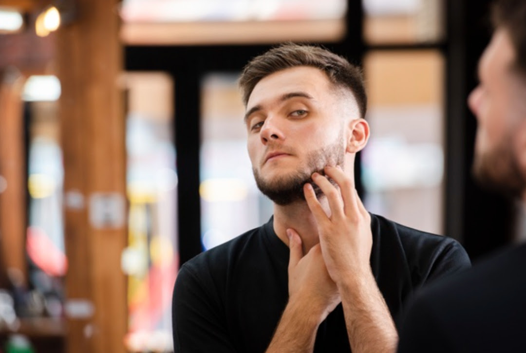 Transplante de barba tem atraído homens: especialistas comentam