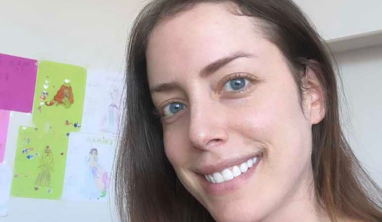 Internada, Fabiana Justus relata queda de cabelo em luta contra o câncer
